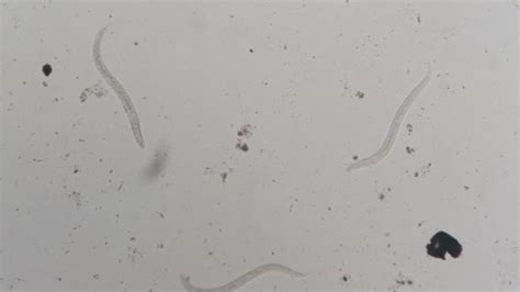 Parasite Strongyloides Stercoralis Human Feces Microscope Testing