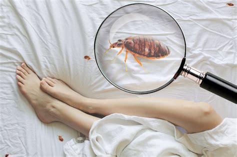 A Guide To Bed Bugs Detection Treatment And Basic Information