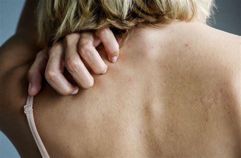 Increased level of epidemic danger. Pin auf Gesundheit