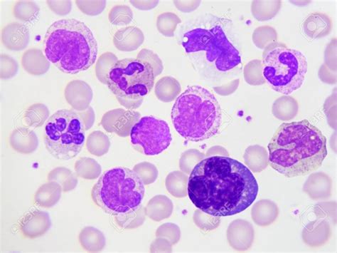Normal white count of white blood cells is approximately 100 billion per day. What are the main functions of white blood cells? - Quora