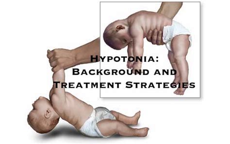Hyptonia Exercises To Help Your Baby With Low Muscle Tone Integrated