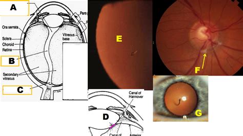 Vitreous I Proprofs Quiz