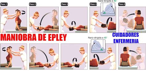 Maniobra De Epley Es Una Serie De Cuidadores Enfermería