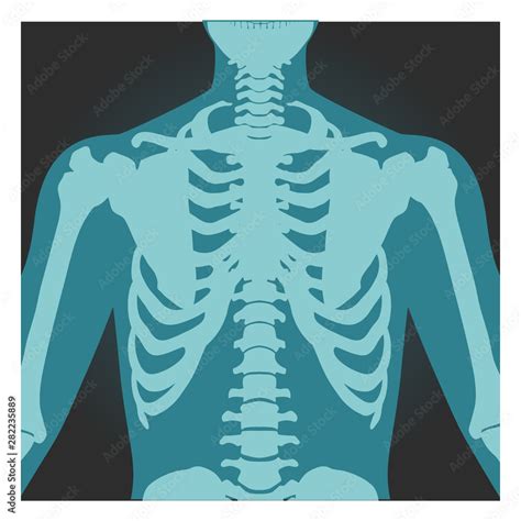 X Ray Shot Of Shoulder Human Body Bones Radiography Rib Cage Chest