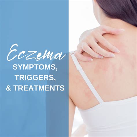 Eczema Symptoms Triggers And Treatments