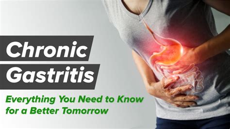 Chronic Gastritis What Is It Causes Symptoms Diagnosis And More
