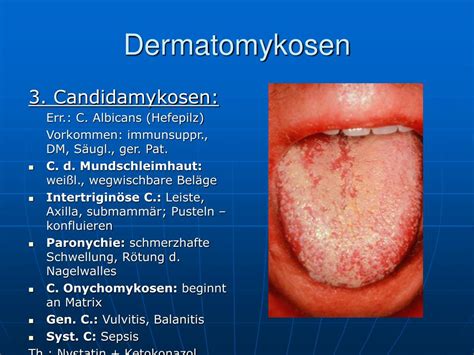 Ppt Dermatologie Powerpoint Presentation Free Download Id324340