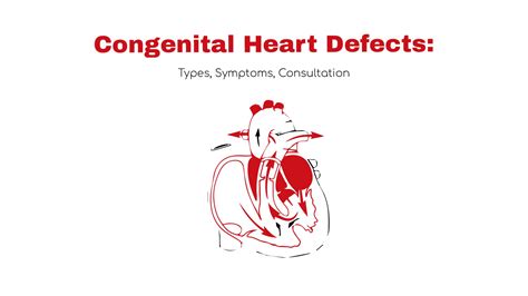 Congenital Heart Defects Types And Symptoms ~ Statcardiologist