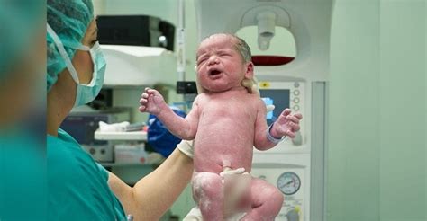 Nace Sin órgano Reproductor Un Caso Que Ocurre En Uno De Cada 30