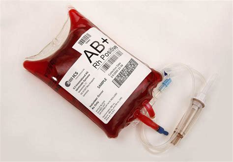 ¿cuáles Son Los Tipos De Transfusión Sanguínea