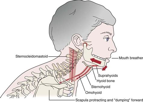 Temporomandibular Joint Musculoskeletal Key