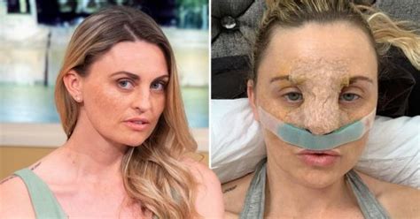 Mum Who Lied To Get Nhs Nose Job Is Now Asking People To Pay For Her Bum Lift Flipboard