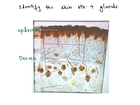 Solved Label The Structures Of Merocrine Sweat Glands Hypodermis
