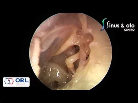 The male throat is bright yellow and the. Dissection Chile 2015 (Middle and Inner Ear) - YouTube