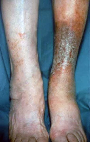 Skin Discoloration Inside Ankle Top Secret Skin Tips