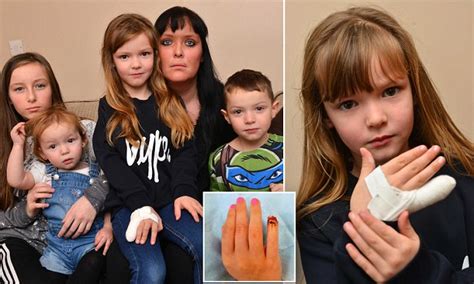 Girl Has Finger Was Sliced Off When Jd Sports Door Closed On Her Hand