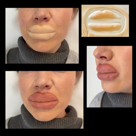 The Botched Lips Set 3 Silicone Lip Prosthetics Lip Filler
