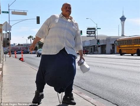 Amazing Stories Around The World Man Made Famous By 132 Pound Scrotum Dies At 49 After Multiple