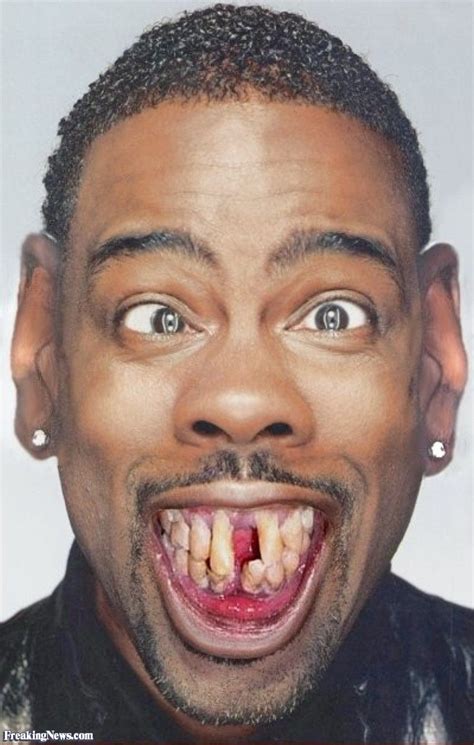 Celebrity Teeth What They Looked Like Before And After Yahoo Image