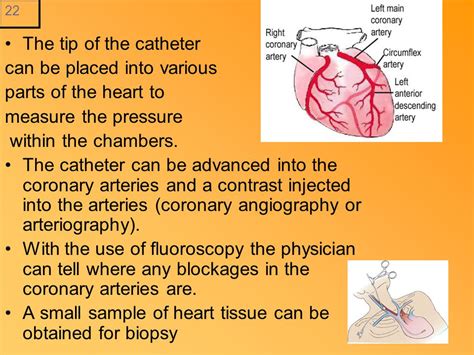 Coronary Angio Cardiac Cath And Ablation Procedures Lecture 3 A Cardiac