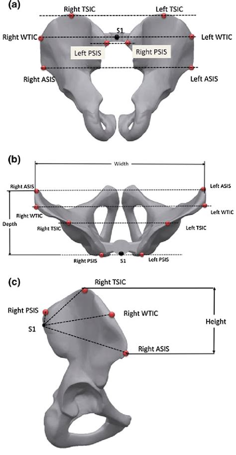 S1 Psis Asis Tsic And Wtic Positions On The Pelvis As Well As The