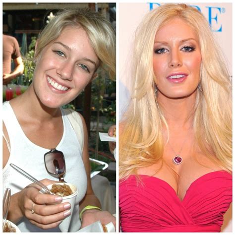Plastic Surgery Gone Wrong Celebs Who Regret Getting Work Done