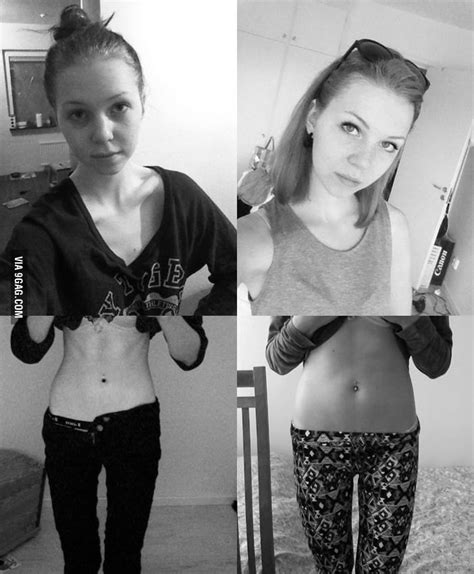 Recovering From Anorexia 9gag