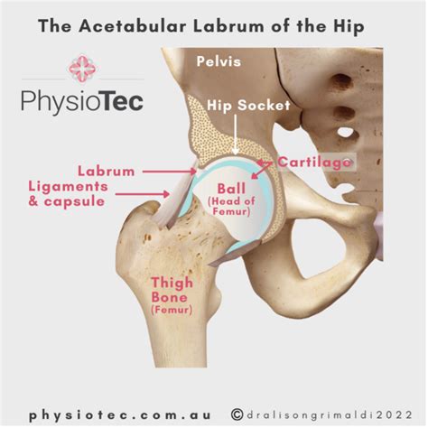All You Need To Know About Hip Labral Tears Physiotec