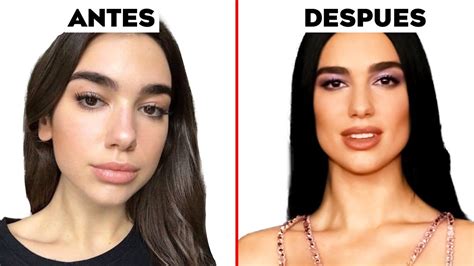 Dua Lipa y su nuevo rostro Qué cirugías estéticas se hizo YouTube