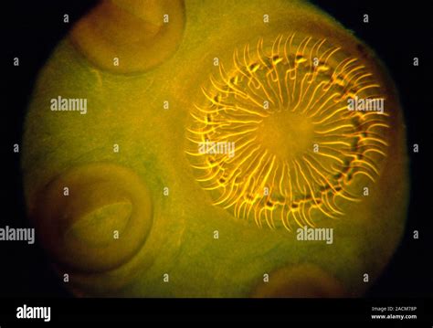 La Tenia Del Cerdo Taenia Solium Scolex Micrografía De Luz Esta