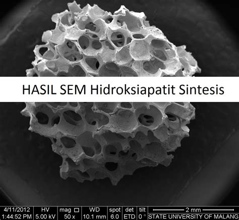 SEM Hidroksiapatit Sintesis Laboratorium Mineral Material Maju Sentral
