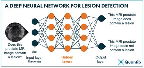 We did not find results for: Deep learning radiology: the secret of convolutional ...