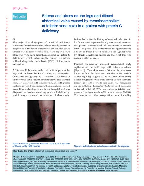 Pdf Edema And Ulcers On The Legs And Dilated Abdominal Veins Caused