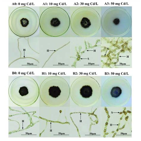 Colonization Of Dark Septate Endophytes Dses In The Roots Of