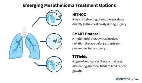 Emerging Mesothelioma Treatments Guide To Promising Therapies