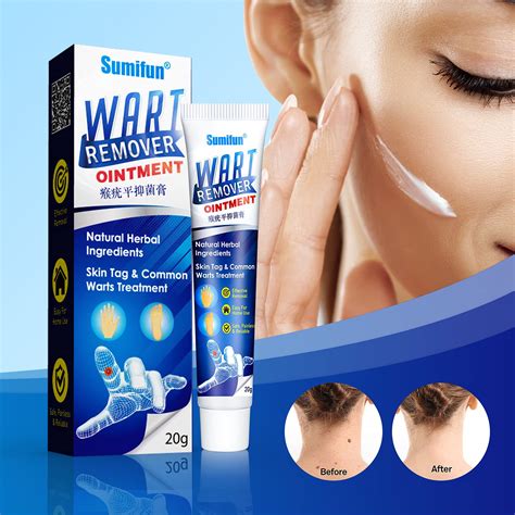 sumifun wart remover ointment 3 counts skin tag remover wart remover cream for common warts