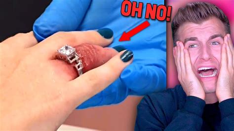 10 000 ring gets permanently stuck on woman s finger youtube