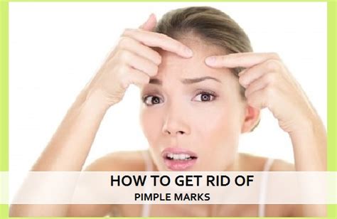 How To Get Rid Of Pimple Marks And Acne Scars At Home