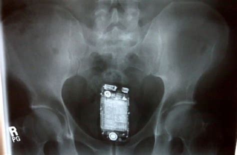 10 Incredible X Rays That You Wont Believe Are Real