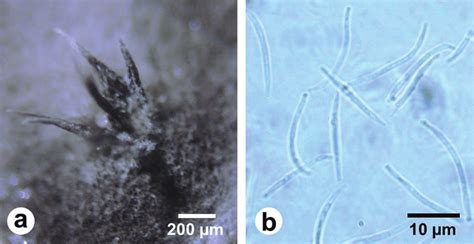 Morphology Of Eutypella Sp Isolate Es 1 A Beak Shaped Pycnidia B