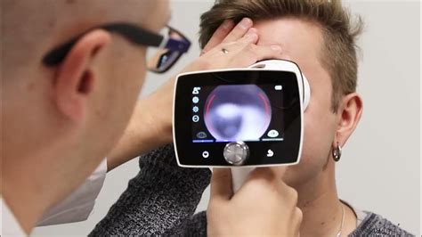 Optomed Aurora Iq Handheld Fundus Camera Presents New Features Youtube