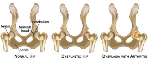 Unfortunately, limping is also a sign of arthritis, another common problem for older dogs, and can lead to a misdiagnosis at first. Hip Dysplasia in Dogs