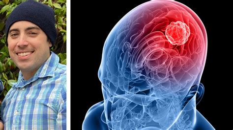 Man Survives Brain Cancer Now His Tumor May Help Others Vitals