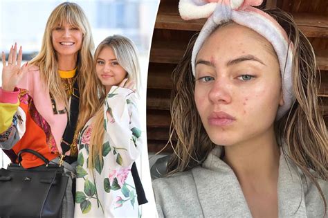 Heidi Klums Daughter Leni 19 Shows Her Breakouts In Makeup Free Selfie