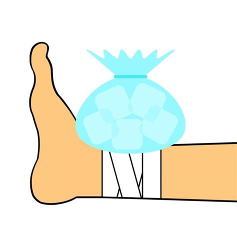 Icing Ankle Illustrations Royalty Free Vector Graphics And Clip Art Istock