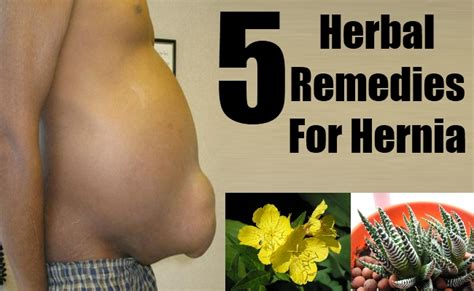 5 Effectual Herbal Remedies For Hernia Natural Home Remedies