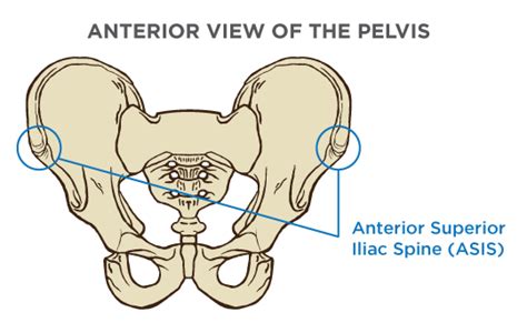 Posterior Superior Iliac Spine Palpation