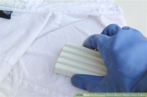 5 Ways To Remove Dried Blood Stains From Fabric Wikihow