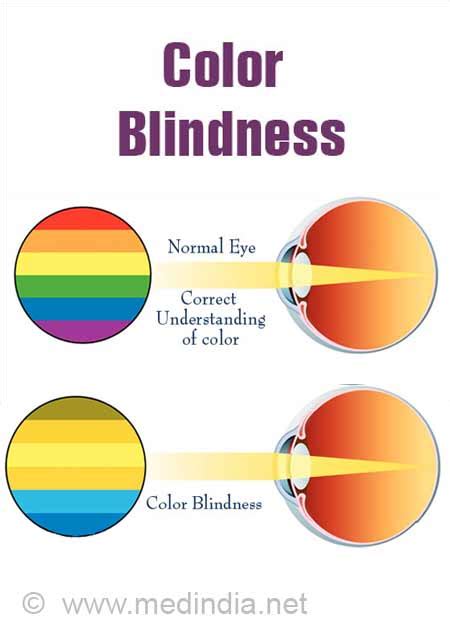 How To Correct Color Blindness Resolutionrecognition4