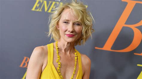 Anne Heche Forensic Medicine Names The Cause Of Death Of The Actress 24 Hours World